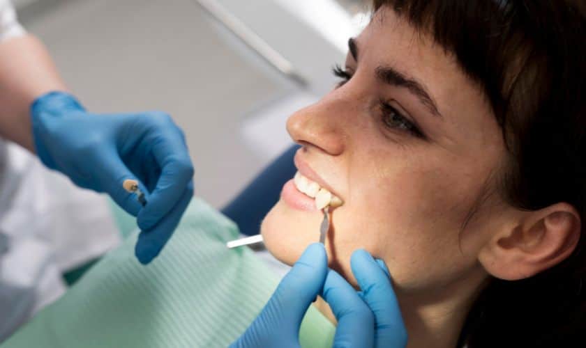 Veneers in Covington, WA