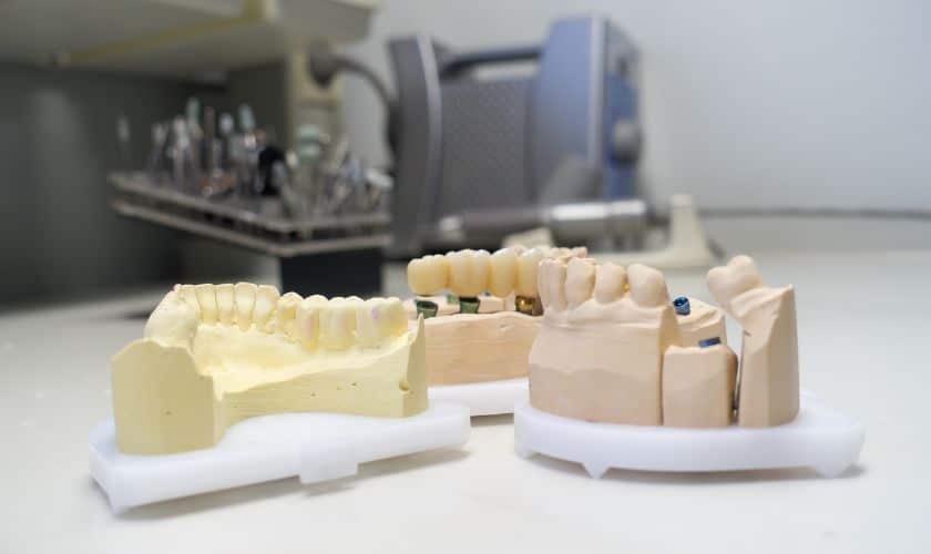 Your Comprehensive Guide To Getting A Dental Crown In Covington