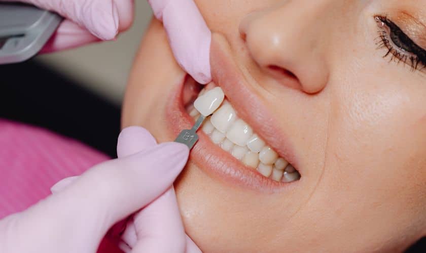 Cosmetic Dentist Covington