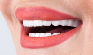Dentist Covington