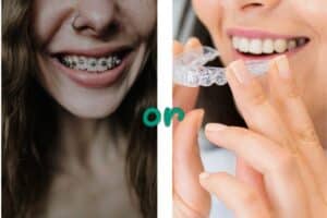 Invisalign & Braces