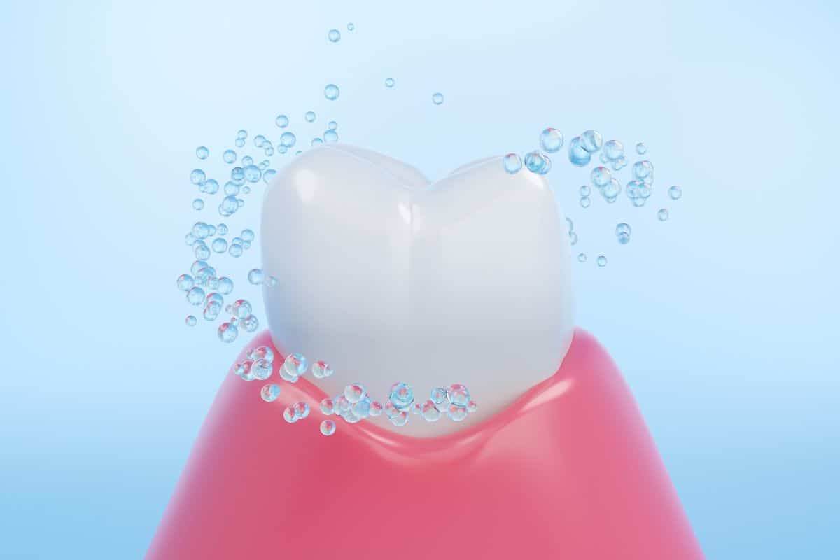 Enamel Erosion