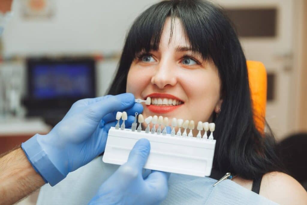 Avoid Stained Veneers: Expert Tips for Radiant White Smiles