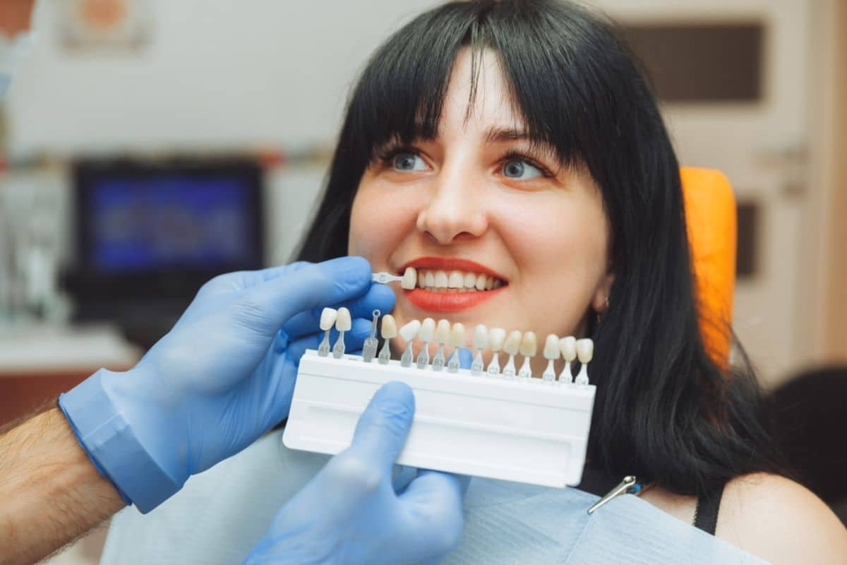 Avoid Stained Veneers: Expert Tips for Radiant White Smiles