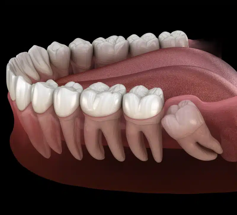 3D dental anatomy illustration showing human teeth and gum structure from side view