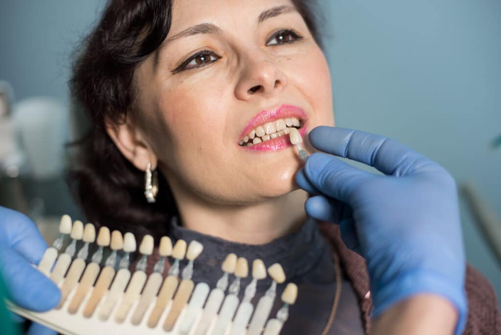 dental veneers and crowns