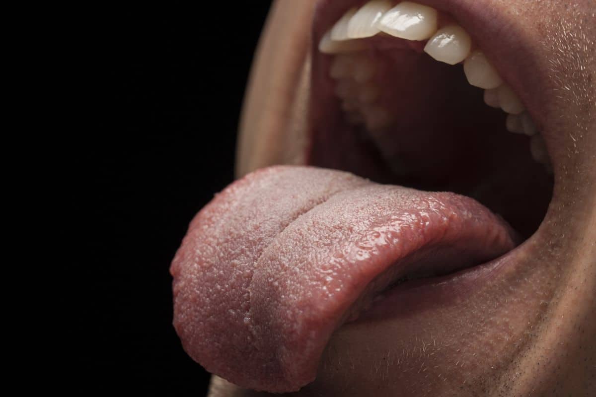 My Tongue Hurt on the Side