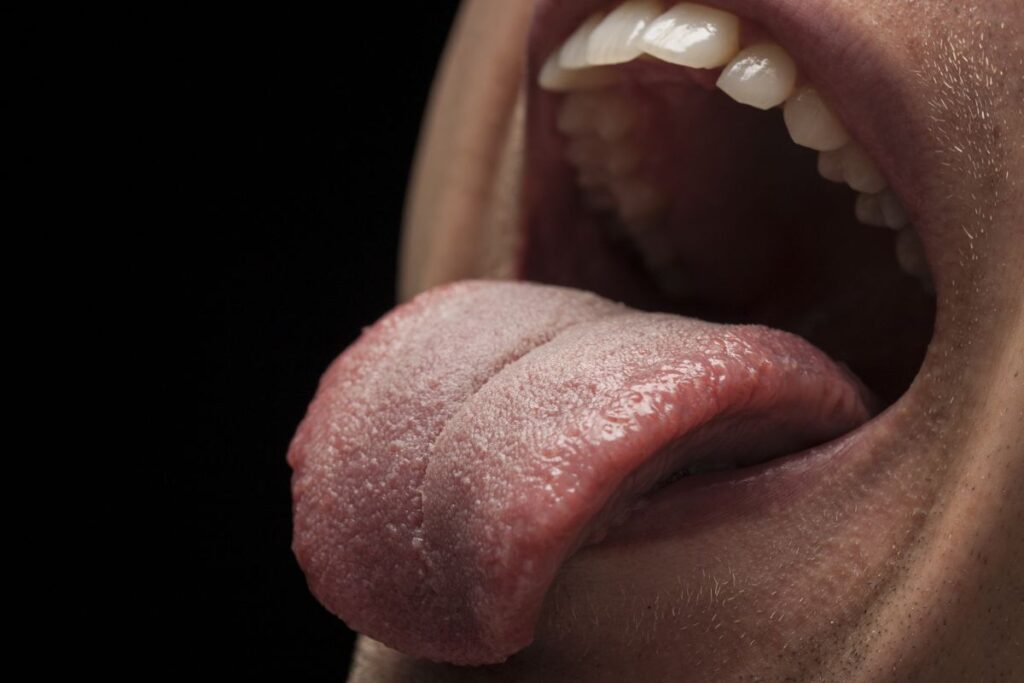 Side of Your Tongue Hurts