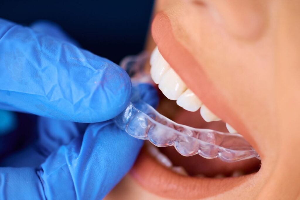 invisalign treatment