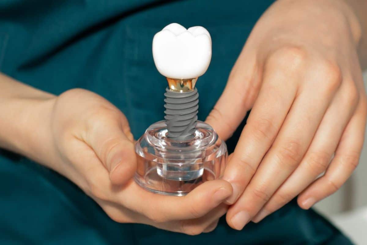 Bone Grafting to Heal Before an Implant